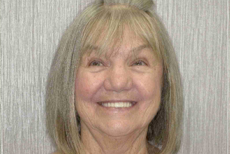 headshot of patient after procedure