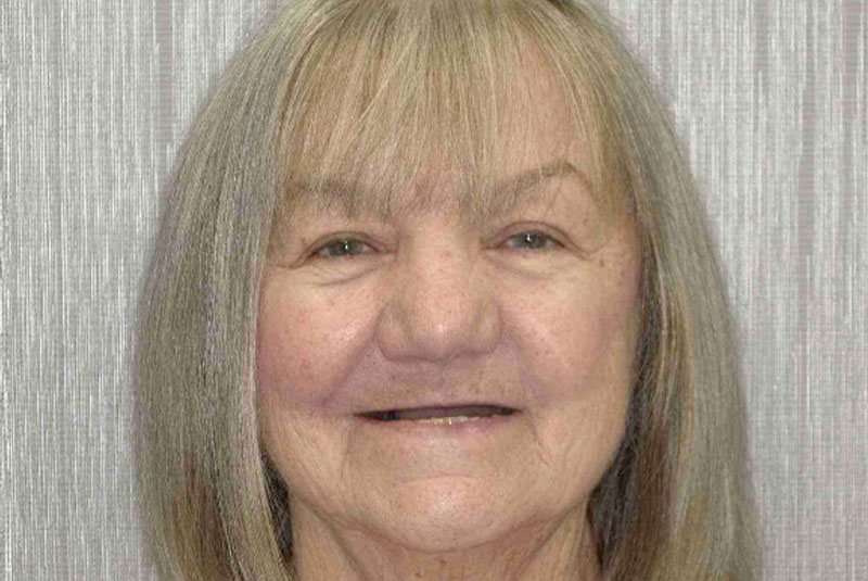headshot of patient before procedure