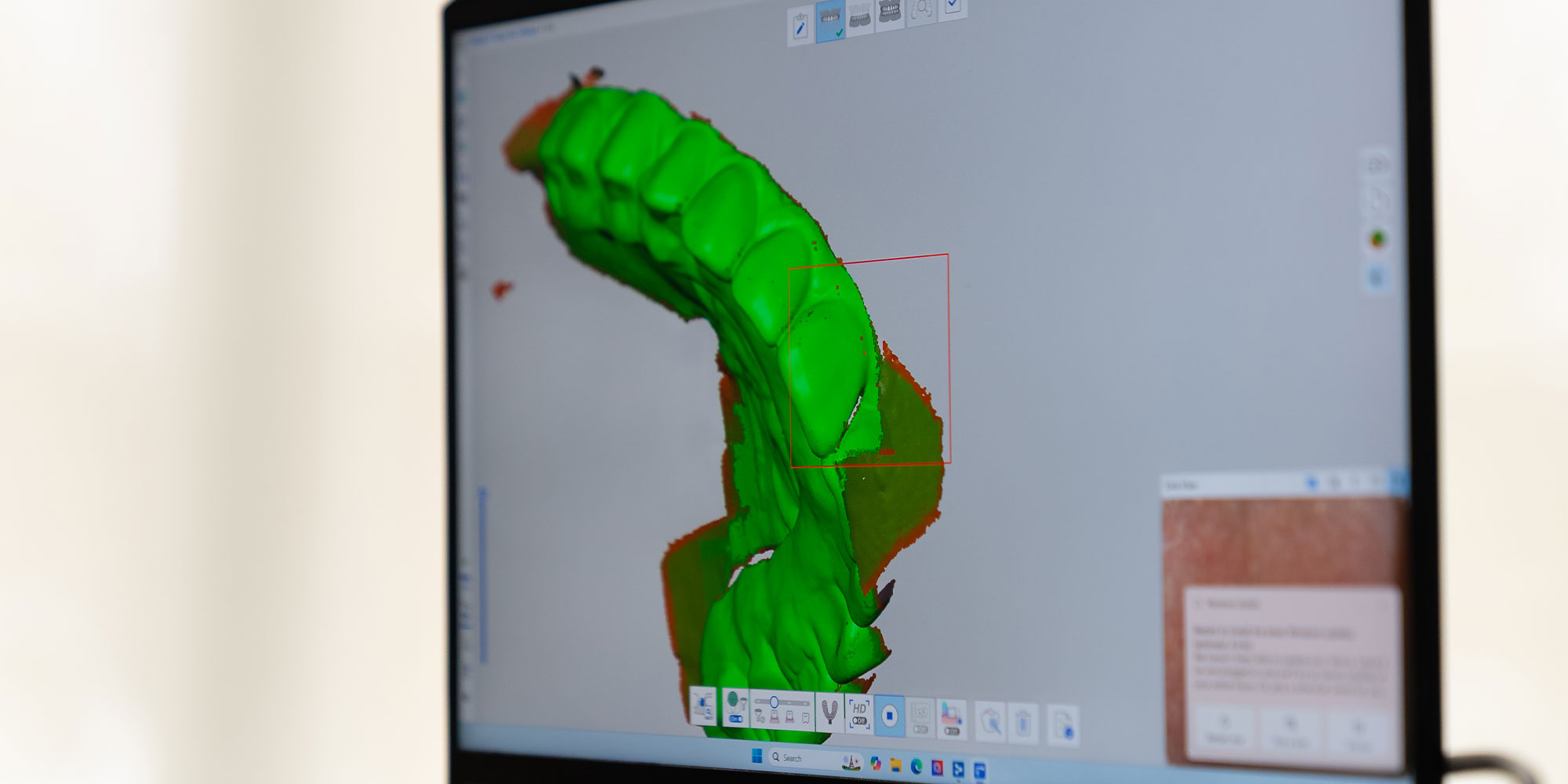 3d scan of patients teeth
