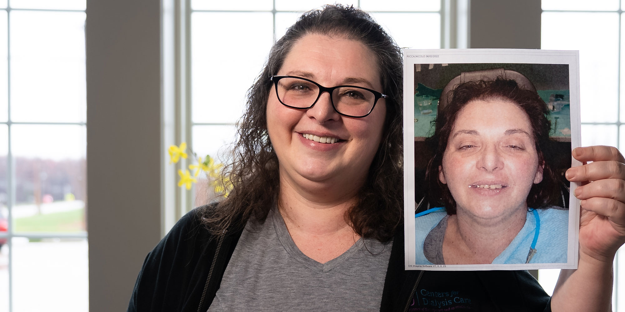 patient holding up a before and after photo
