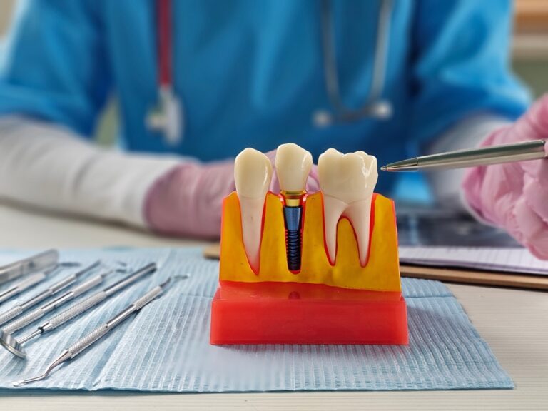 Patient consulting with a dentist in a modern dental office about dental implants