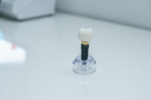 Dentist consulting a patient about bone graft for dental implants