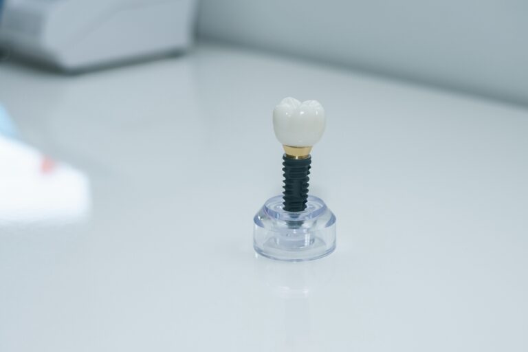 Dentist consulting a patient about bone graft for dental implants