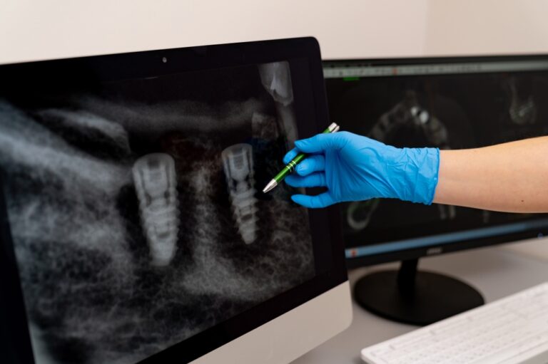 Implant-supported dentures consultation in dental office